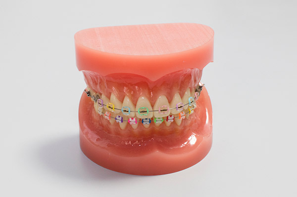 矯正歯科治療の保険適用について